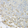 Immunohistochemistry of paraffin-embedded Rat liver using TROVE2 Polyclonal Antibody at dilution of  1:100 (40x lens).