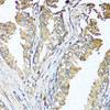 Immunohistochemistry of paraffin-embedded Human prostate using STK3 Polyclonal Antibody at dilution of  1:100 (40x lens).