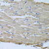Immunohistochemistry of paraffin-embedded Rat heart using TARS Polyclonal Antibody at dilution of  1:100 (40x lens).