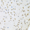 Immunohistochemistry of paraffin-embedded Mouse brain using TARS Polyclonal Antibody at dilution of  1:100 (40x lens).