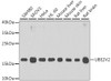 Western blot analysis of extracts of various cell lines using UBE2V2 Polyclonal Antibody at dilution of 1:1000.