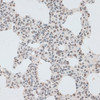 Immunohistochemistry of paraffin-embedded Rat lung using ZNF148 Polyclonal Antibody at dilution of  1:100 (40x lens).