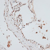 Immunohistochemistry of paraffin-embedded Human lung using ZNF148 Polyclonal Antibody at dilution of  1:100 (40x lens).