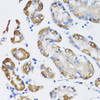 Immunohistochemistry of paraffin-embedded Human stomach using NAA10 Polyclonal Antibody at dilution of  1:100 (40x lens).