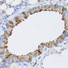 Immunohistochemistry of paraffin-embedded Mouse lung using NAA10 Polyclonal Antibody at dilution of  1:100 (40x lens).