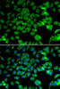 Immunofluorescence analysis of U2OS cells using NAA10 Polyclonal Antibody