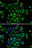 Immunofluorescence analysis of A-549 cells using DYRK2 Polyclonal Antibody