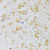 Immunohistochemistry of paraffin-embedded Mouse brain using EIF2B2 Polyclonal Antibody at dilution of  1:100 (40x lens).