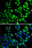 Immunofluorescence analysis of A-549 cells using USP8 Polyclonal Antibody
