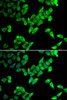 Immunofluorescence analysis of U2OS cells using TRIP10 Polyclonal Antibody