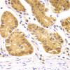 Immunohistochemistry of paraffin-embedded Human stomach using SCO2 Polyclonal Antibody at dilution of  1:100 (40x lens).