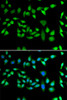 Immunofluorescence analysis of U2OS cells using DNAJB6 Polyclonal Antibody