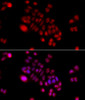 Immunofluorescence analysis of HeLa cells using DNAJB6 Polyclonal Antibody at dilution of  1:100 (40x lens). Blue: DAPI for nuclear staining.