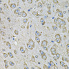 Immunohistochemistry of paraffin-embedded Mouse brain using PDIA6 Polyclonal Antibody at dilution of  1:100 (40x lens).