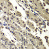 Immunohistochemistry of paraffin-embedded Human stomach using SUB1 Polyclonal Antibody at dilution of  1:100 (40x lens).