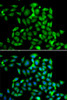 Immunofluorescence analysis of A549 cells using CLASP1 Polyclonal Antibody