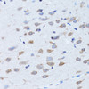 Immunohistochemistry of paraffin-embedded Rat brain using LDLRAP1 Polyclonal Antibody at dilution of  1:100 (40x lens).