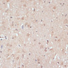 Immunohistochemistry of paraffin-embedded Rat brain using NAA20 Polyclonal Antibody at dilution of  1:100 (40x lens).