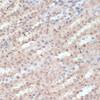 Immunohistochemistry of paraffin-embedded Rat kidney using NAA20 Polyclonal Antibody at dilution of  1:100 (40x lens).