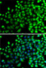 Immunofluorescence analysis of A-549 cells using NAA20 Polyclonal Antibody