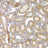 Immunohistochemistry of paraffin-embedded Rat kidney using ANAPC5 Polyclonal Antibody at dilution of  1:100 (40x lens).
