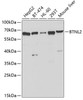 Western blot analysis of extracts of various cell lines using BTNL2 Polyclonal Antibody at dilution of 1:1000.