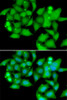 Immunofluorescence analysis of A549 cells using UBASH3B Polyclonal Antibody