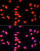 Immunofluorescence analysis of L929 cells using COMMD1 Polyclonal Antibody at dilution of  1:100. Blue: DAPI for nuclear staining.