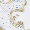 Immunohistochemistry of paraffin-embedded Human prostate using KIAA1456 Polyclonal Antibody at dilution of  1:200 (40x lens).