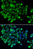 Immunofluorescence analysis of MCF-7 cells using NAT9 Polyclonal Antibody