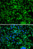 Immunofluorescence analysis of A-549 cells using PHYHD1 Polyclonal Antibody