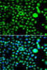 Immunofluorescence analysis of MCF-7 cells using SMCHD1 Polyclonal Antibody