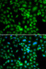 Immunofluorescence analysis of MCF-7 cells using SYCE1 Polyclonal Antibody