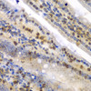 Immunohistochemistry of paraffin-embedded Mouse Intestine using SYNCRIP Polyclonal Antibody at dilution of  1:100 (40x lens).
