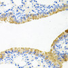 Immunohistochemistry of paraffin-embedded Mouse lung using TOB2 Polyclonal Antibody at dilution of  1:100 (40x lens).