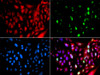 Immunofluorescence analysis of GFP-RNF168 transgenic U2OS cells using UIMC1 Polyclonal Antibody