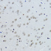 Immunohistochemistry of paraffin-embedded Mouse brain using Acetyl-Histone H3-K27 Polyclonal Antibody at dilution of  1:200 (40x lens).