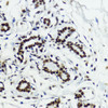 Immunohistochemistry of paraffin-embedded Human breast using Acetyl-Histone H3-K27 Polyclonal Antibody at dilution of  1:200 (40x lens).