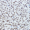 Immunohistochemistry of paraffin-embedded Rat ovary using Acetyl-Histone H3-K9 Polyclonal Antibody at dilution of  1:200 (40x lens).