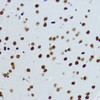 Immunohistochemistry of paraffin-embedded Mouse brain using Acetyl-Histone H3-K9 Polyclonal Antibody at dilution of  1:200 (40x lens).