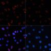 Immunofluorescence analysis of C6 cells using Acetyl-Histone H3-K56 Polyclonal Antibody at dilution of  1:100.C6 cells were treated by TSA (1 uM) at 37℃ for 18 hours (left).Blue: DAPI for nuclear staining.