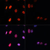 Immunofluorescence analysis of NIH/3T3 cells using Acetyl-Histone H3-K56 Polyclonal Antibody at dilution of  1:100.NIH/3T3 cells were treated by TSA (1 uM) at 37℃ for 18 hours (left).Blue: DAPI for nuclear staining.