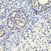Immunohistochemistry of paraffin-embedded Rat ovary using Acetyl-Histone H3-K18 Polyclonal Antibody at dilution of  1:100 (40x lens).