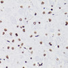 Immunohistochemistry of paraffin-embedded Rat brain using Acetyl-Histone H3-K18 Polyclonal Antibody at dilution of  1:100 (40x lens).