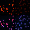 Immunofluorescence analysis of HeLa cells using Acetyl-Histone H3-K18 Polyclonal Antibody at dilution of  1:100.HeLa cells were treated by TSA (1 uM) at 37℃ for 18 hours. Blue: DAPI for nuclear staining.