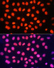 Immunofluorescence analysis of HeLa cells using TriMethyl-Histone H3-K64 Polyclonal Antibody at dilution of  1:100. Blue: DAPI for nuclear staining.