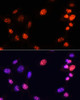 Immunofluorescence analysis of NIH/3T3 cells using TriMethyl-Histone H3-K64 Polyclonal Antibody at dilution of  1:100. Blue: DAPI for nuclear staining.