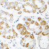 Immunohistochemistry of paraffin-embedded Human stomach using MCP-1 Polyclonal Antibody at dilution of  1:100 (40x lens).
