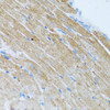 Immunohistochemistry of paraffin-embedded Mouse heart using MCP-1 Polyclonal Antibody at dilution of  1:100 (40x lens).