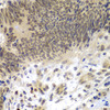 Immunohistochemistry of paraffin-embedded Human colon carcinoma using CEBPG Polyclonal Antibody at dilution of  1:100 (40x lens).
